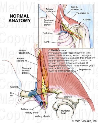 Brachial Plexus 399048 04Apart2