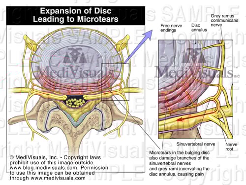 Sinuvertebral Nerves