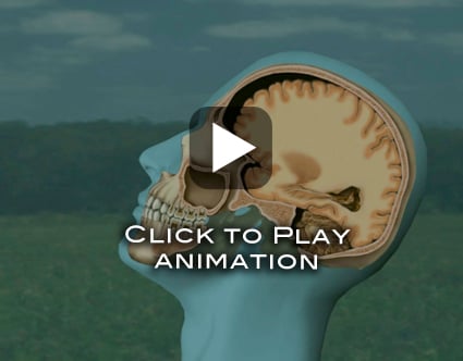 TBIanimation still