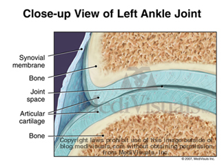 arthritis-joint-normal