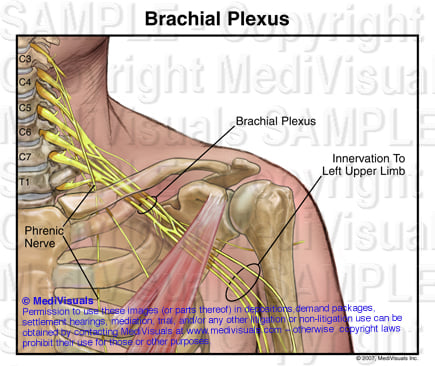Brachial Plexus 205299 02XA