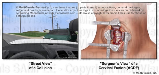 Cross Section Blog image1 REVISED