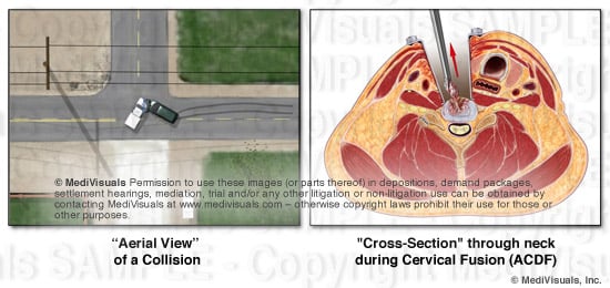 Cross Section Blog image2 REVISED