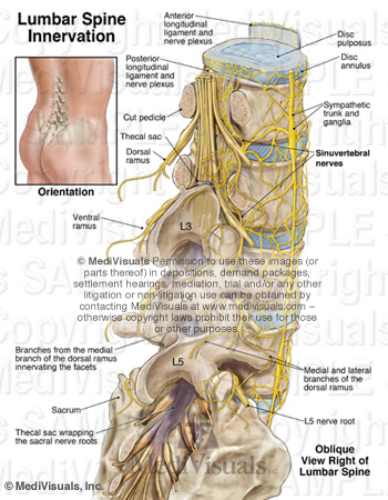 Discogenic Pain - Back Pain and Radiculopathy Without Evidence of ...