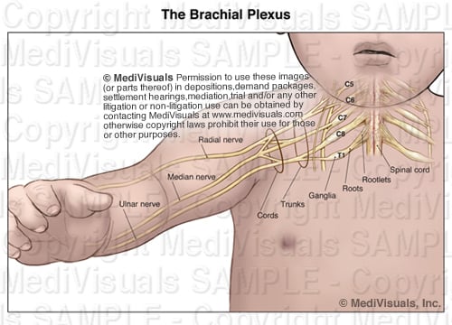Pediatric Brachial Plexus